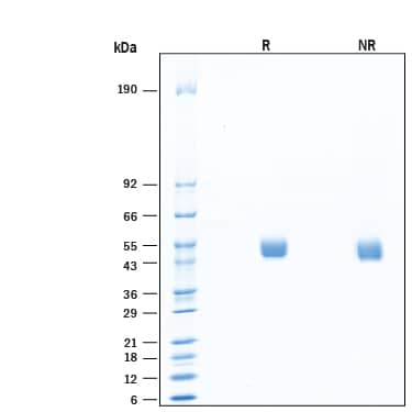 SDS-Page alpha-Galactosidase A/GLA [Unconjugated]