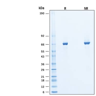 2 μg/lane of Recombinant Human POR/Cytochrome P450 Reductase His-tag Protein (Catalog # 6340-PRB) was resolved with SDS-PAGE under reducing (R) and non-reducing (NR) conditions and visualized by Coomassie® Blue staining, showing bands at 63-69 kDa, under reducing conditions.