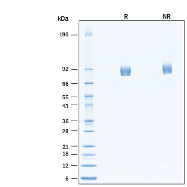 2 μg/lane of Recombinant Human  beta ‑Galactosidase‑1/GLB1 Protein (Catalog # 6464-GH) was resolved with SDS-PAGE under reducing (R) and non-reducing (NR) conditions and visualized by Coomassie® Blue staining, showing bands at 70-95 kDa.