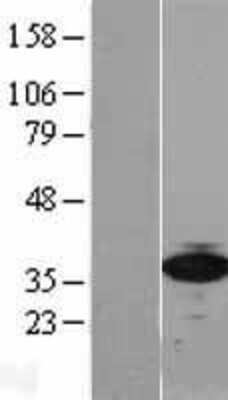 Western Blot RPSA Overexpression Lysate