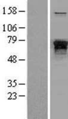 Western Blot NF-L Overexpression Lysate