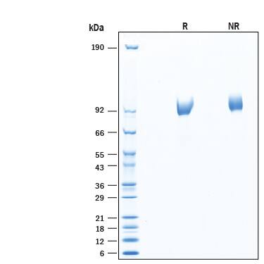 2 μg/lane of Recombinant Human NAGLU Protein (Catalog # 7096-GH) was resolved with SDS-PAGE under reducing (R) and non-reducing (NR) conditions and visualized by Coomassie® Blue staining, showing bands at 70-95 kDa.