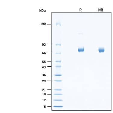 SDS-Page Galactosylceramidase/GALC [Unconjugated]