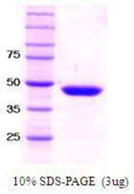 SDS-PAGE Recombinant Human SETD7/9 Protein