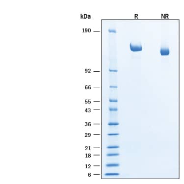 2 μg/lane of Recombinant Human Caspr2 His-tag Protein (Catalog # 8207-CRB) was resolved with SDS-PAGE under reducing (R) and non-reducing (NR) conditions and visualized by Coomassie® Blue staining, showing bands at 130-150 kDa, under reducing conditions.
