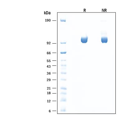 2 μg/lane of Recombinant Human Lysosomal alpha-Glucosidase/GAA Protein (Catalog # 8329-GH) was resolved with SDS-PAGE under reducing (R) and non-reducing (NR) conditions and visualized by Coomassie® Blue staining, showing bands at 95-105 kDa.
