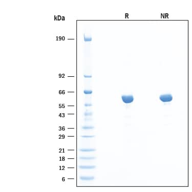 2 μg/lane of Recombinant Human Sulfamidase/SGSH Protein (Catalog # 8380-SU) was resolved with SDS-PAGE under reducing (R) and non-reducing (NR) conditions and visualized by Coomassie® Blue staining, showing bands at 55-63 kDa.