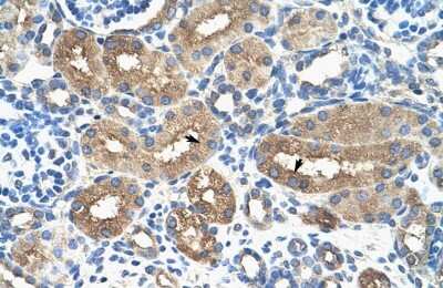 Immunohistochemistry: A-Myb Antibody [NBP2-86995] - Human kidney