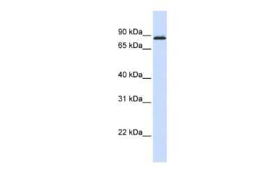 Western Blot: A-Myb Antibody [NBP2-86997] - WB Suggested Anti-MYBL1 Antibody Titration: 0.2-1 ug/ml. ELISA Titer: 1:12500. Positive Control: Human Muscle