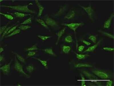 Immunocytochemistry/Immunofluorescence: A-RAF Antibody [H00000369-D01P] - Analysis of antibody to ARAF on HeLa cell. Antibody concentration 30 ug/ml.