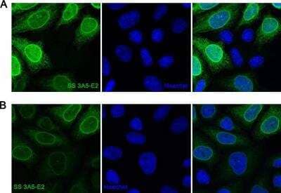 Immunocytochemistry/Immunofluorescence: A. aeolicus BPL/BioID2 Antibody (SS 3A5-E2) [NBP2-59941] - Staining of HeLa polyclonal cell line expressing BioID2 tagged to TorsinA  delta E302/3 with SS 3A5-E2 monoclonal antibody. Cells were fixed in (A) cold methanol or (B) 4% PFA and stained with SS anti-BPL R40G/BioID2 3A5-E2 antibody (in green). The nuclei were counter-stained with Hoechst.