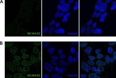 Immunocytochemistry/Immunofluorescence: A. aeolicus BPL/BioID2 Antibody (SS 3A5-E2) [NBP2-59941] - A) Parental HEK293T or (B) monoclonal HEK293T cell line with BioID2 knocked-in into at least one LMNA gene alleles (resulting in BioID2 Lamin A/C fusion protein) were immunofluorescently labelled with anti-BPL R40G/BioID2 SS 3A5-E2 monoclonal antibody (green). The nuclei were visualized with Hoechst.