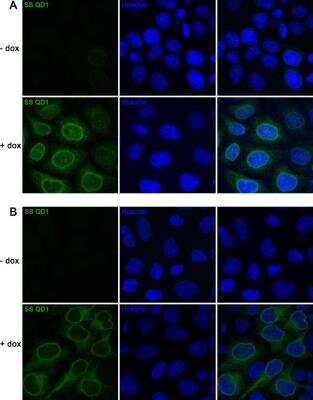 Immunocytochemistry/Immunofluorescence: A. aeolicus BPL/BioID2 Antibody (SS QD1) [NBP2-59940] - Staining of HeLa cell line expressing doxycycline (dox) - inducible BioID2 tagged to TorsinA  delta E302/3 with SS QD1 monoclonal antibody. Uninduced (-dox) or induced (+dox) cells were fixed in (A) cold methanol or (B) 4% PFA and stained with anti-BPL R40G/BioID2 SS QD1 antibody (in green). The nuclei were counter-stained with Hoechst.