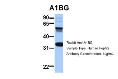 Western Blot: alpha 1B-Glycoprotein Antibody [NBP1-57965] -  Sample Type: HepG2 Antibody Dilution: 1.0 ug/ml ACAT2 is supported by BioGPS gene expression data to be expressed in HepG2