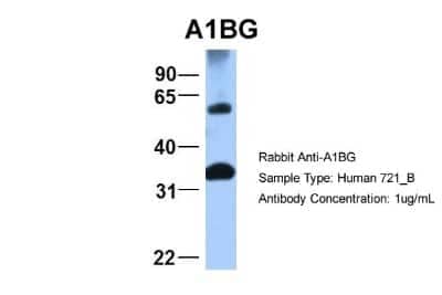 Western Blot: alpha 1B-Glycoprotein Antibody [NBP1-57965] - Sample Type: 721_B Antibody Dilution: 1.0 ug/ml ACAT2 is supported by BioGPS gene expression data to be expressed in 721_B