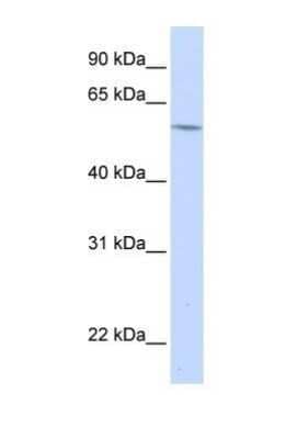 Western Blot: alpha 1B-Glycoprotein Antibody [NBP1-57969] - HepG2 tissue lysate at a concentration of 1ug/ml.