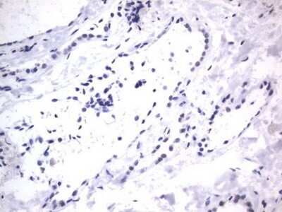 Immunohistochemistry: A2BP1 Antibody (OTI4F9) - Azide and BSA Free [NBP2-71965] - Analysis of Human thyroid tissue. (Heat-induced epitope retrieval by 1 mM EDTA in 10mM Tris, pH8.5, 120C for 3min)