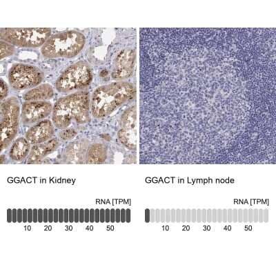 Immunohistochemistry-Paraffin: A2LD1 Antibody [NBP2-38064] - Staining in human kidney and lymph node tissues using anti-GGACT antibody. Corresponding GGACT RNA-seq data are presented for the same tissues.