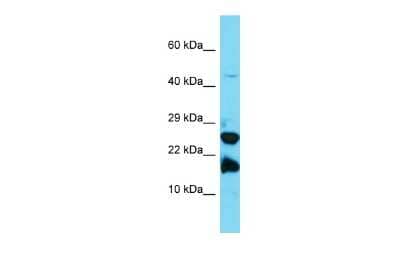 Western Blot: A2LD1 Antibody [NBP2-82542] - Host: Rabbit. Target Name: A2LD1. Sample Type: Jurkat Whole Cell lysates. Antibody Dilution: 1.0ug/ml