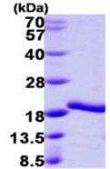 SDS-Page: A2LD1 Protein [NBP1-78799] - 15% SDS-PAGE (3 ug).