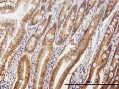 Immunohistochemistry-Paraffin: A33/GPA33 Antibody [H00010223-B01] - Analysis of antibody to GPA33 on formalin-fixed paraffin-embedded human small Intestine. Antibody concentration 3 ug/ml
