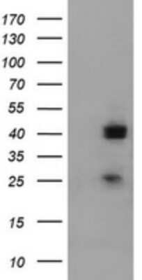 Western Blot: A4GNT Antibody (OTI2H9) - Azide and BSA Free [NBP2-71905] - Analysis of HEK293T cells were transfected with the pCMV6-ENTRY control (Left lane) or pCMV6-ENTRY A4GNT.