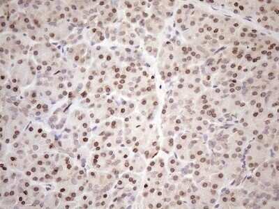 Immunohistochemistry: AAAS Antibody (OTI5B10) - Azide and BSA Free [NBP2-71358] - Analysis of Human pancreas tissue. (Heat-induced epitope retrieval by 1mM EDTA in 10mM Tris buffer (pH8.5) at 120C for 3 min)