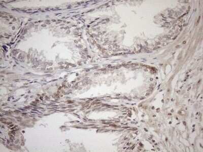 Immunohistochemistry: AAAS Antibody (OTI5B10) - Azide and BSA Free [NBP2-71358] - Analysis of Human prostate tissue. (Heat-induced epitope retrieval by 1mM EDTA in 10mM Tris buffer (pH8.5) at 120C for 3 min)