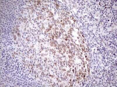 Immunohistochemistry: AAAS Antibody (OTI5B10) - Azide and BSA Free [NBP2-71358] - Analysis of Human tonsil tissue. (Heat-induced epitope retrieval by 1mM EDTA in 10mM Tris buffer (pH8.5) at 120C for 3 min)