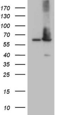 Western Blot: AAAS Antibody (OTI5B10) - Azide and BSA Free [NBP2-71358] - Analysis of HEK293T cells were transfected with the pCMV6-ENTRY control (Left lane) or pCMV6-ENTRY AAAS.