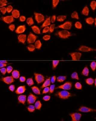 Immunocytochemistry/Immunofluorescence: AADAC Antibody [NBP2-92619] - Analysis of 293T cells using AADAC . Blue: DAPI for nuclear staining.
