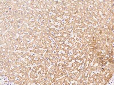 Immunohistochemistry-Paraffin: AADAC Antibody [NBP2-99385] - Immunochemical staining of human AADAC in human liver with rabbit polyclonal antibody at 1:300 dilution, formalin-fixed paraffin embedded sections.