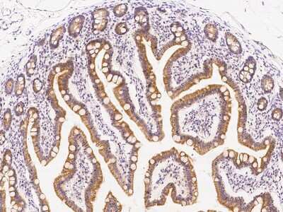 Immunohistochemistry-Paraffin: AADAC Antibody [NBP2-99385] - Immunochemical staining of human AADAC in human liver with rabbit polyclonal antibody at 1:300 dilution, formalin-fixed paraffin embedded sections.