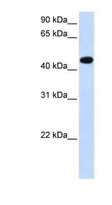 Western Blot: AADAC Antibody [NBP1-62428] - Transfected 293T cell lysate, concentration 0.2-1 ug/ml.