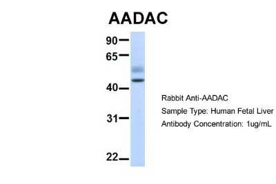 Western Blot: AADAC Antibody [NBP1-62428] - Human Fetal Liver, Antibody Dilution: 1.0 ug/ml.