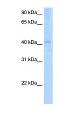Western Blot: AADAC Antibody [NBP1-69445] - This Anti-AADAC antibody was used in Western Blot of Fetal Liver tissue lysate at a concentration of 2.5ug/ml.