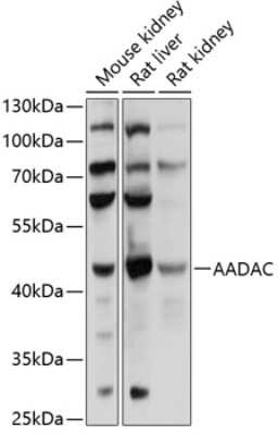 Western Blot AADAC Antibody - BSA Free