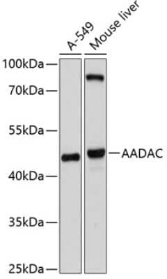 Western Blot: AADAC Antibody [NBP2-92698] - Analysis of extracts of various cell lines, using AADAC at 1:1000 dilution.Secondary antibody: HRP Goat Anti-Rabbit IgG (H+L) at 1:10000 dilution.Lysates/proteins: 25ug per lane.Blocking buffer: 3% nonfat dry milk in TBST.Detection: ECL Basic Kit .Exposure time: 30s.