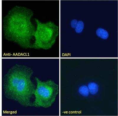 Immunofluorescence: AADACL1 Antibody [NBP2-76805] - Analysis of paraformaldehyde fixed U2OS cells, permeabilized with 0.15% Triton. Primary incubation 1hr (1:50 dilution) followed by Alexa Fluor 488 secondary antibody (2 ug/ml), showing Endoplasmic reticulum staining. The nuclear stain is DAPI (blue). Negative control: Unimmunized goat IgG (10 ug/ml) followed by Alexa Fluor 488 secondary antibody (2 ug/ml).