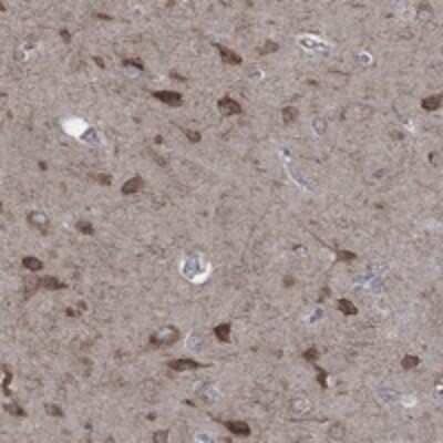 Immunohistochemistry-Paraffin: AADACL1 Antibody [NBP3-17795] - Staining of human cerebral cortex shows strong cytoplasmic positivity in neuronal cells.