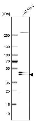 Western Blot AADACL1 Antibody - BSA Free