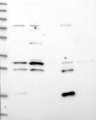 Western Blot AADACL1 Antibody - BSA Free