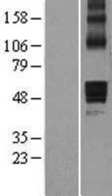 Western Blot: AADACL1 Overexpression Lysate (Adult Normal) [NBL1-07162] Left-Empty vector transfected control cell lysate (HEK293 cell lysate); Right -Over-expression Lysate for AADACL1.