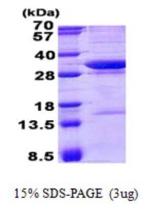 SDS-PAGE Recombinant Human AADACL1 His Protein