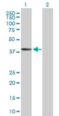 Western Blot: AADACL2 Antibody [H00344752-B01P] - Analysis of AADACL2 expression in transfected 293T cell line by AADACL2 polyclonal antibody.  Lane 1: AADACL2 transfected lysate(41.69 KDa). Lane 2: Non-transfected lysate.
