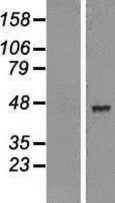 Western Blot: AADACL2 Overexpression Lysate (Native) [NBL1-07163] - Left: Control HEK293 lysate Right: Over-expression lysate