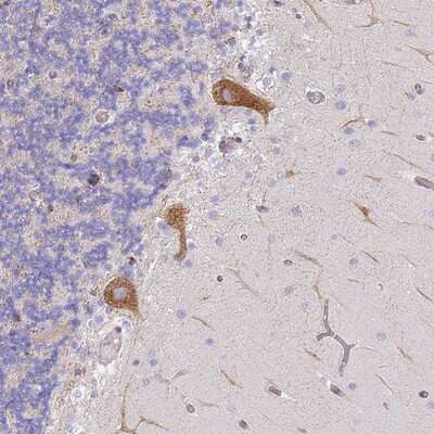 Immunohistochemistry-Paraffin AADACL4 Antibody - BSA Free