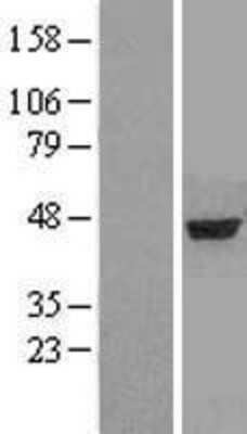 Western Blot: alpha-Aminoadipate Aminotransferase Overexpression Lysate [NBL1-07164] -  Left-Empty vector transfected control cell lysate (HEK293 cell lysate); Right -Over-expression Lysate for AADAT.