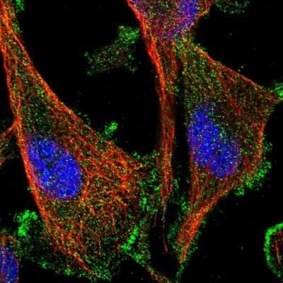 Immunocytochemistry/Immunofluorescence: AAK1 Antibody [NBP1-84110] - Staining of human cell line U-251 MG shows localization to plasma membrane.