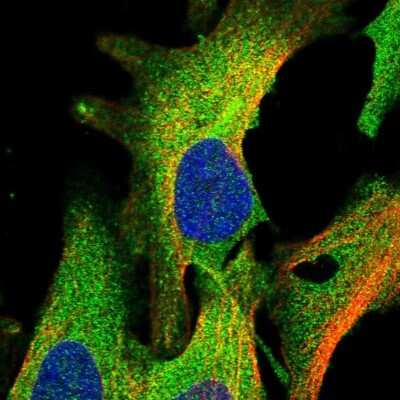 Immunocytochemistry/ Immunofluorescence AAK1 Antibody